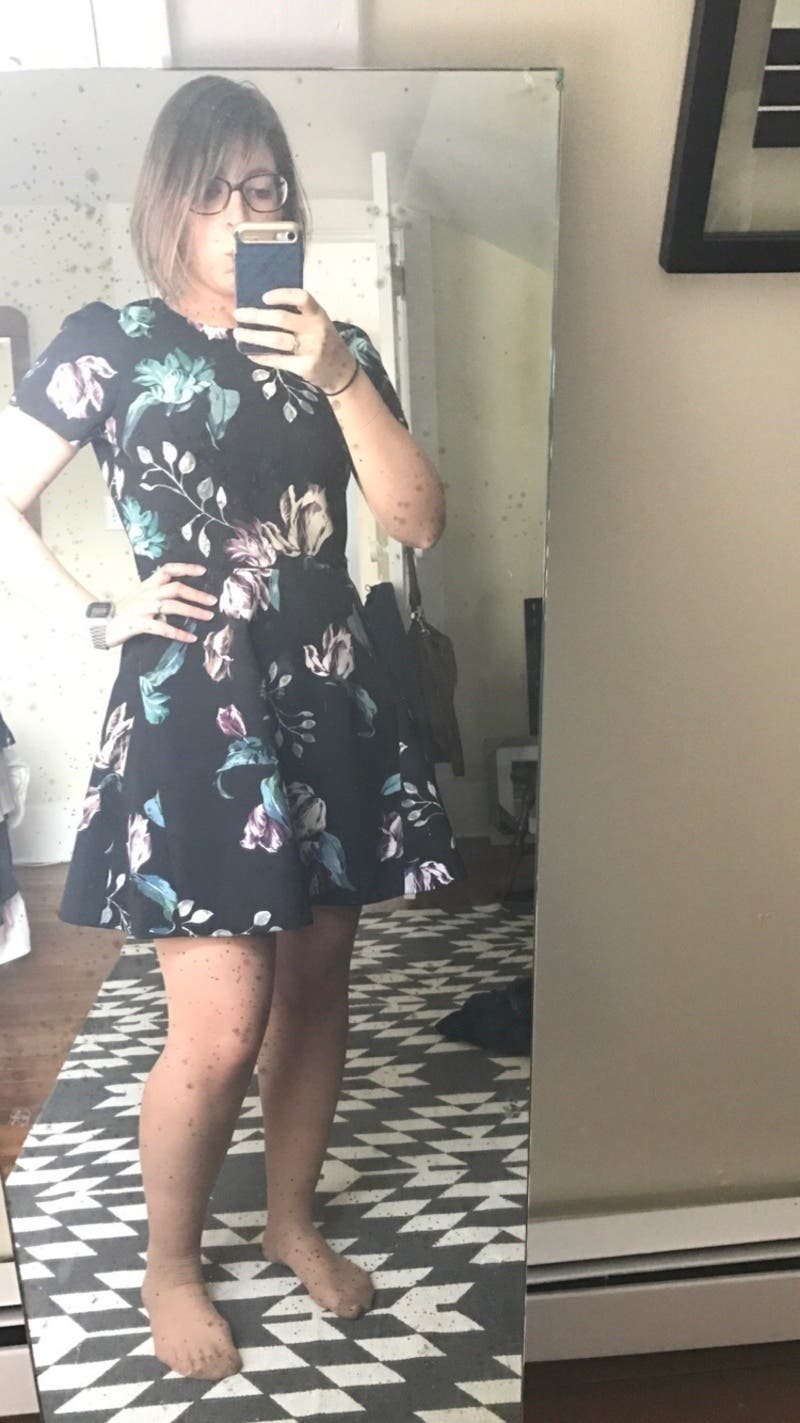 Alison