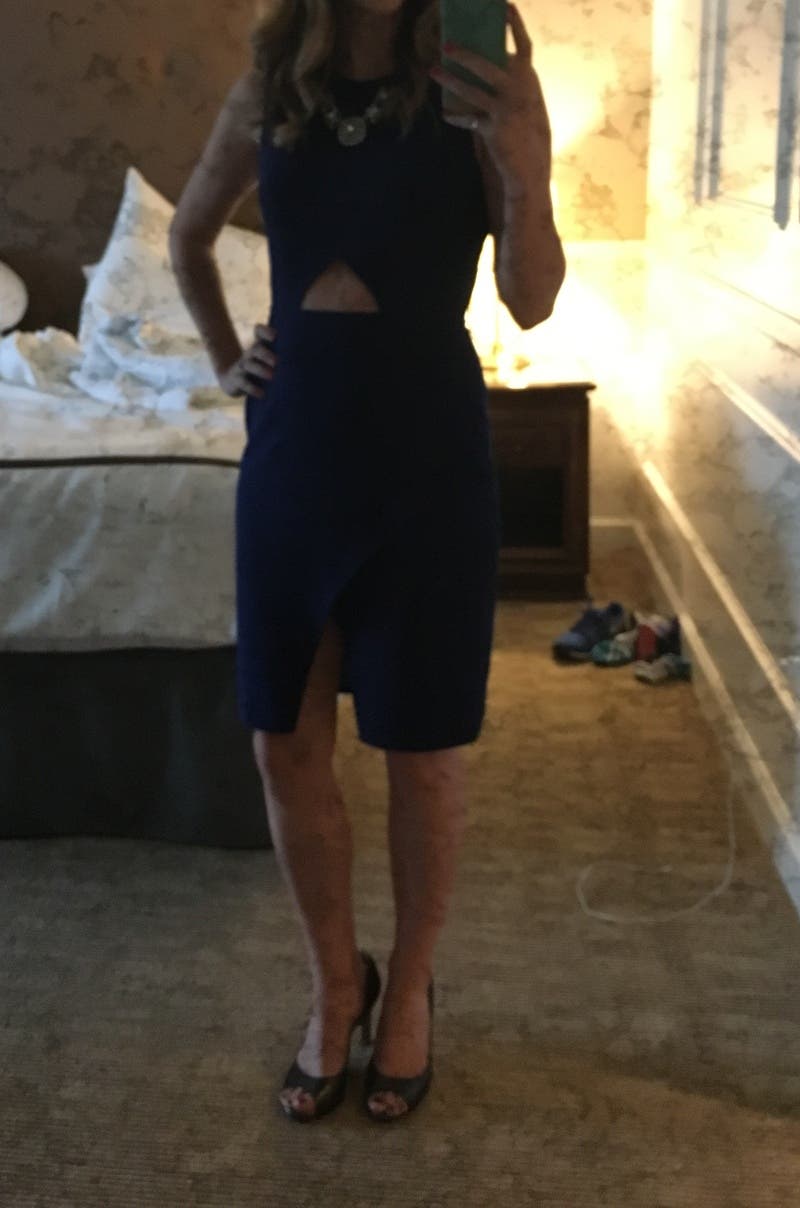Liz
