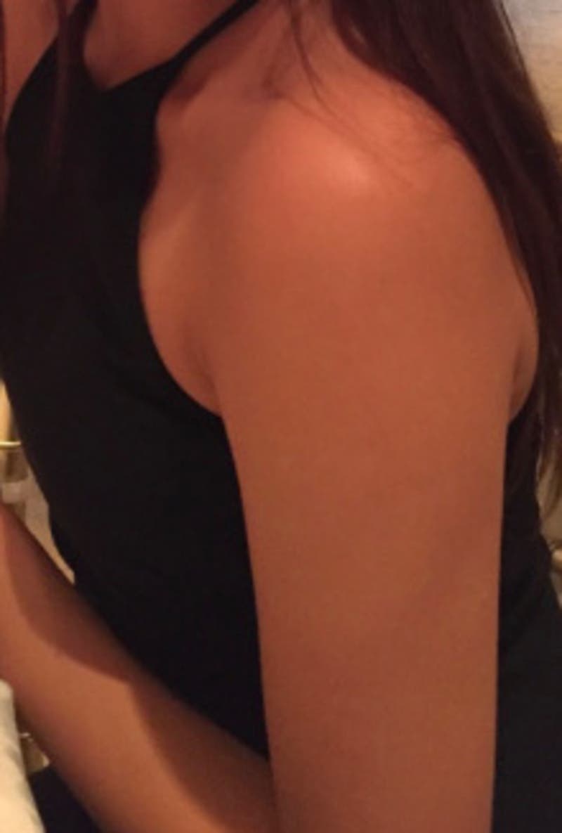 Erika