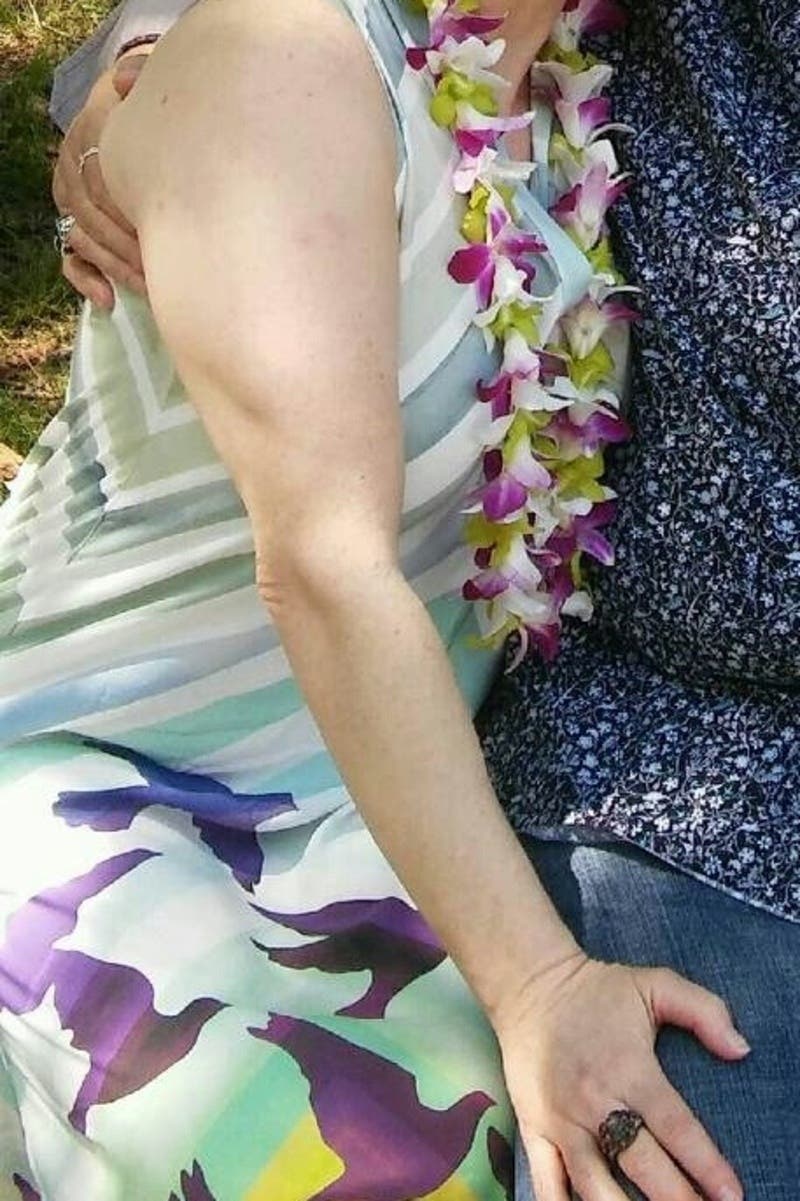 Akiko