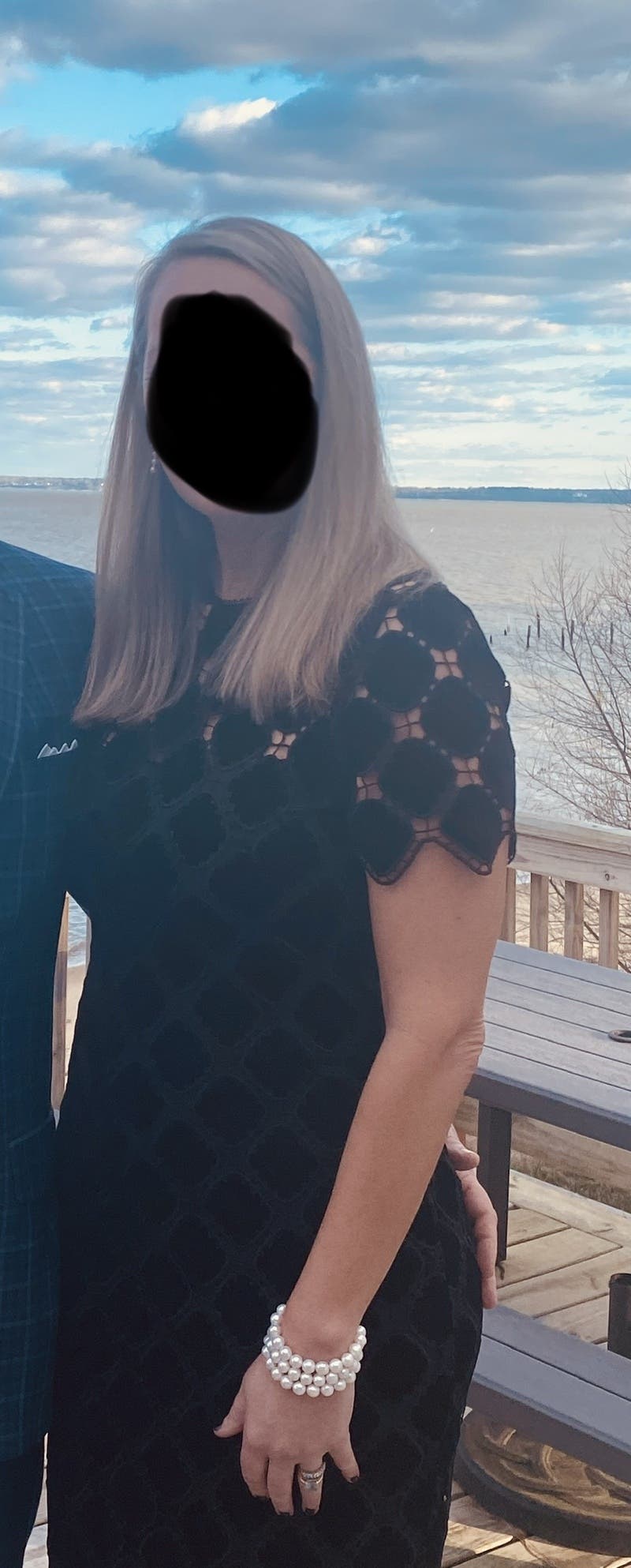 Allison
