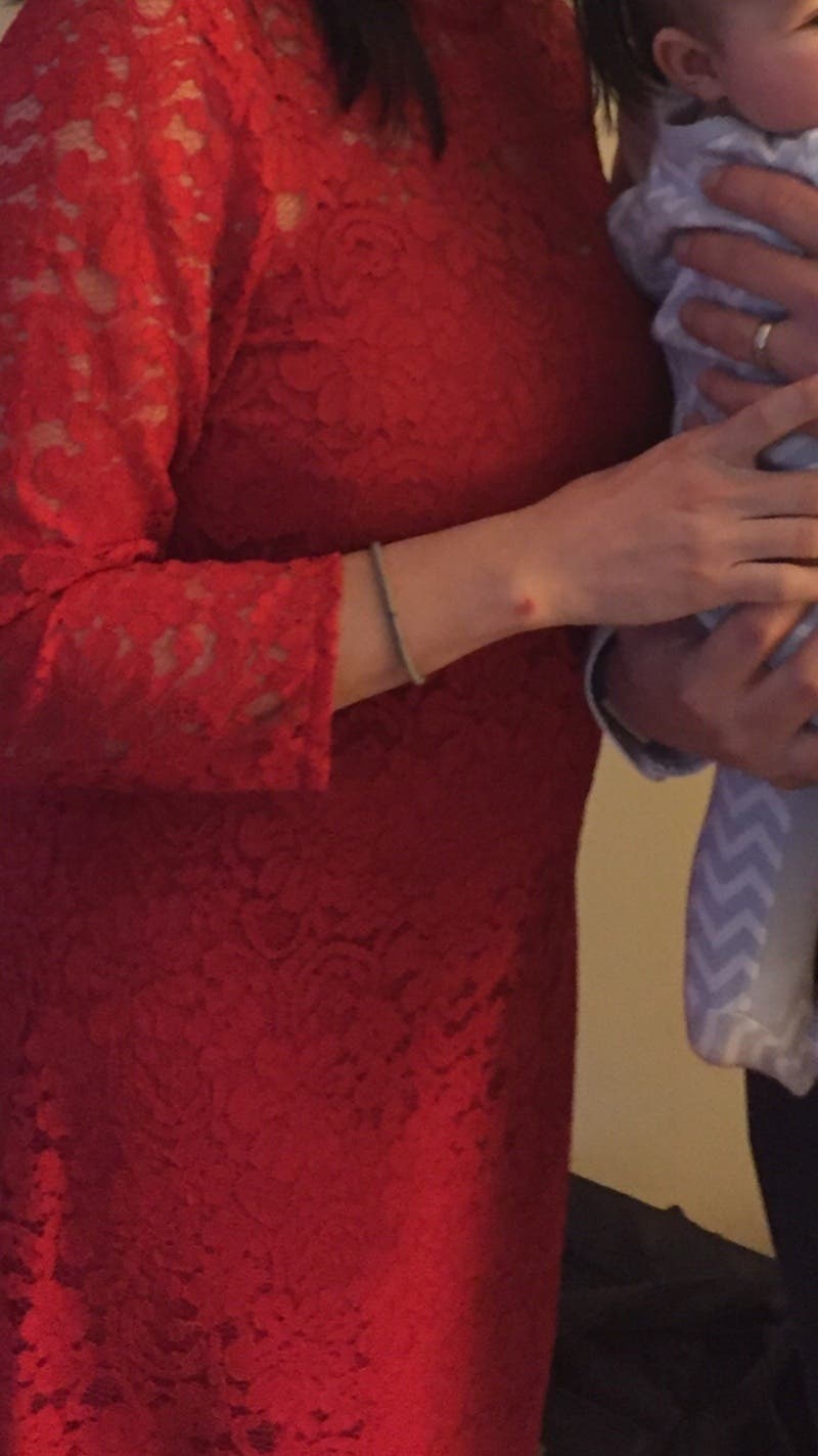 Alison
