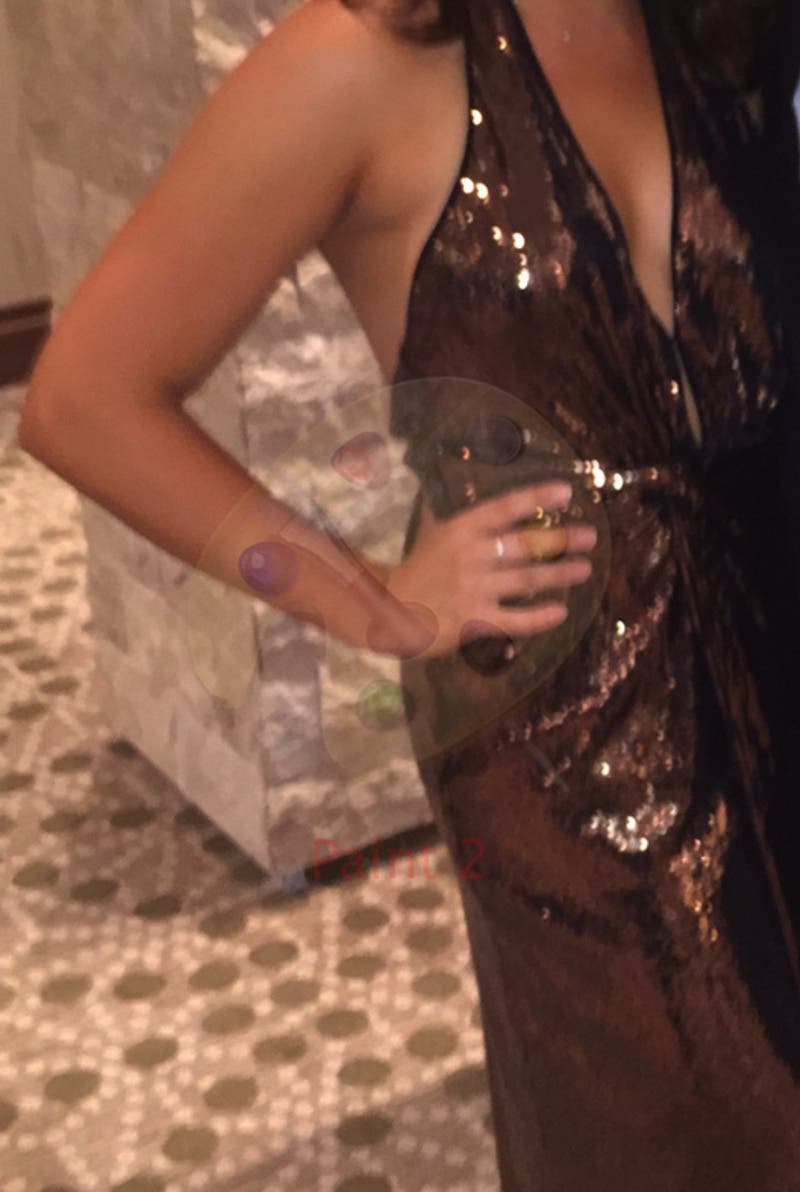Allison