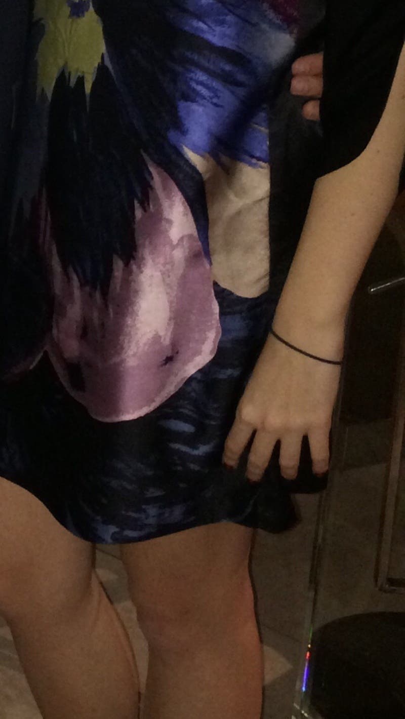 Lindsey