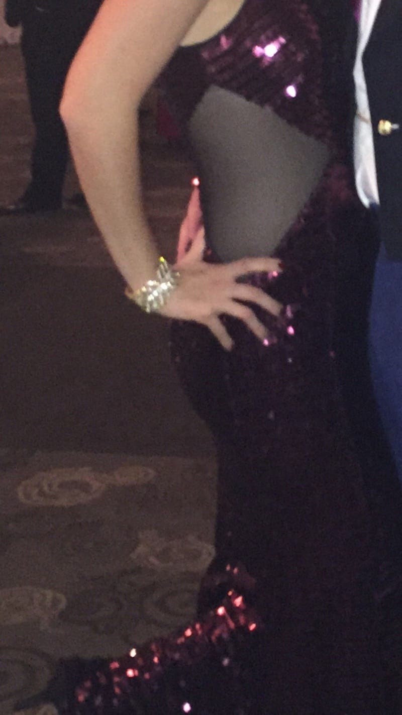 Allyse
