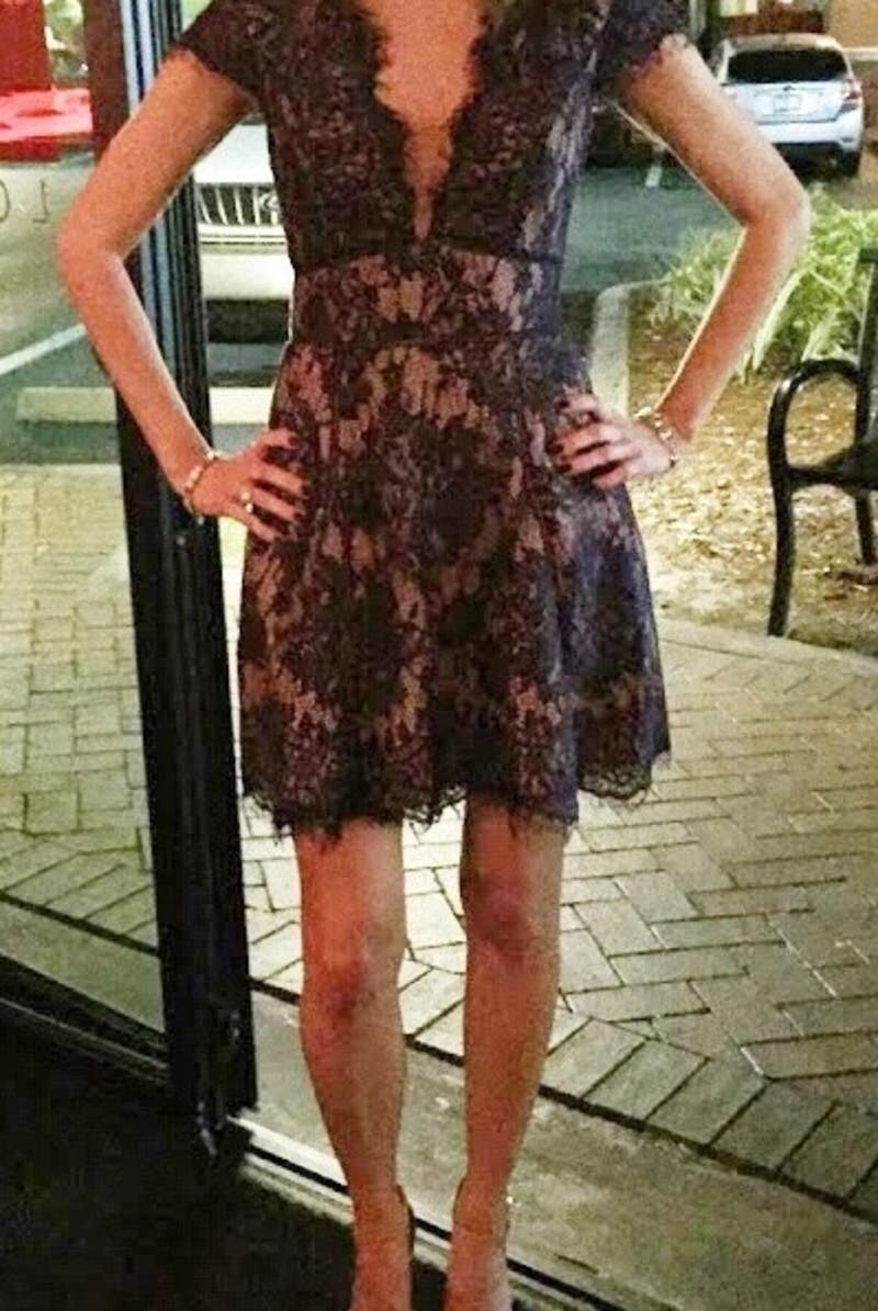 Allison