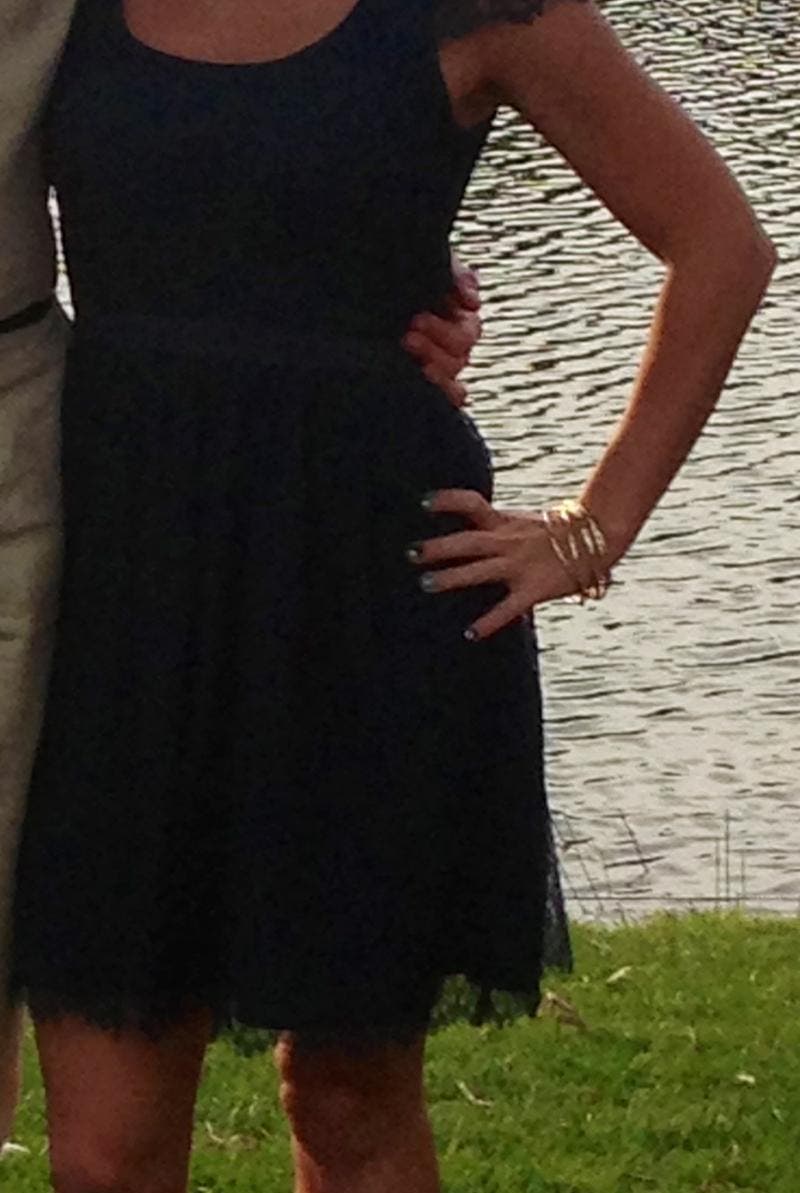 Allison