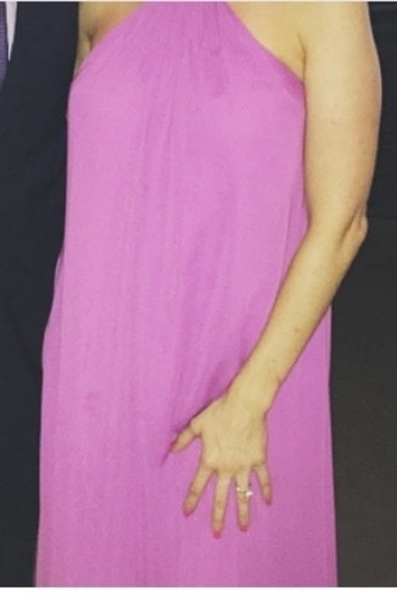 Nicole