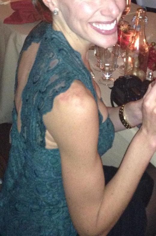 Melissa