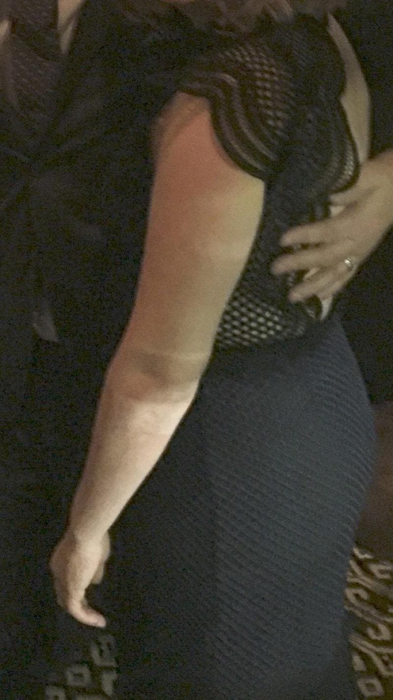 Allison