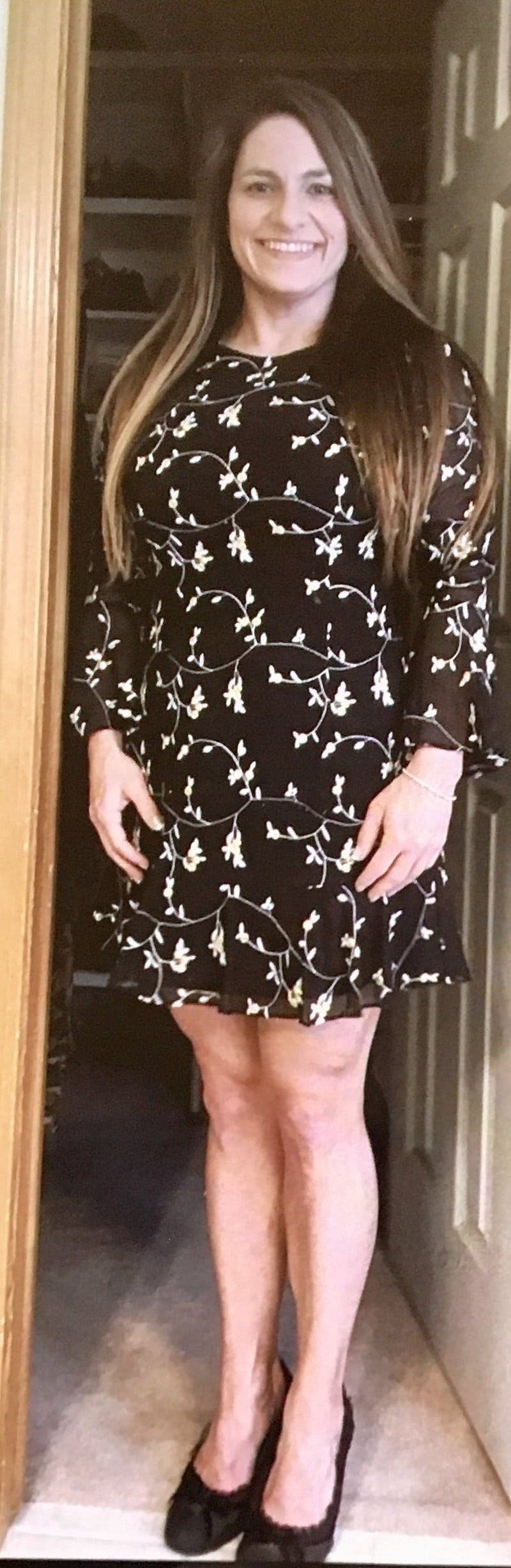 Allison