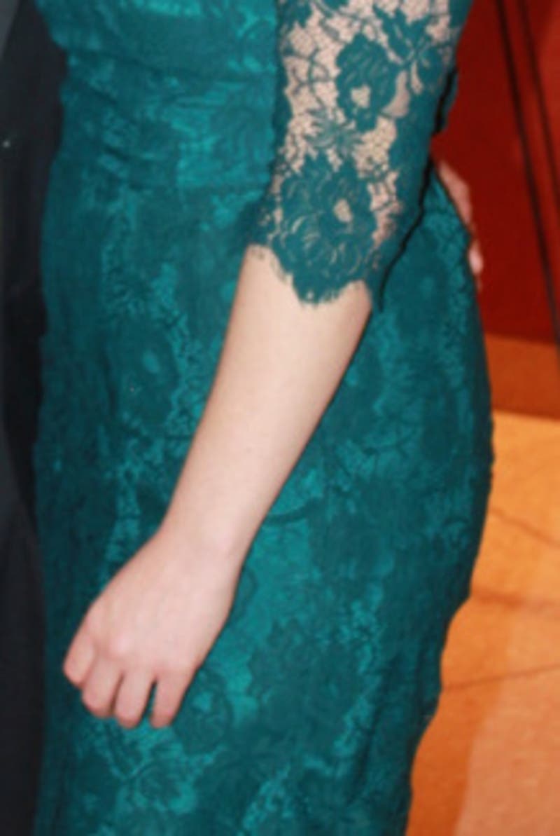 Allison