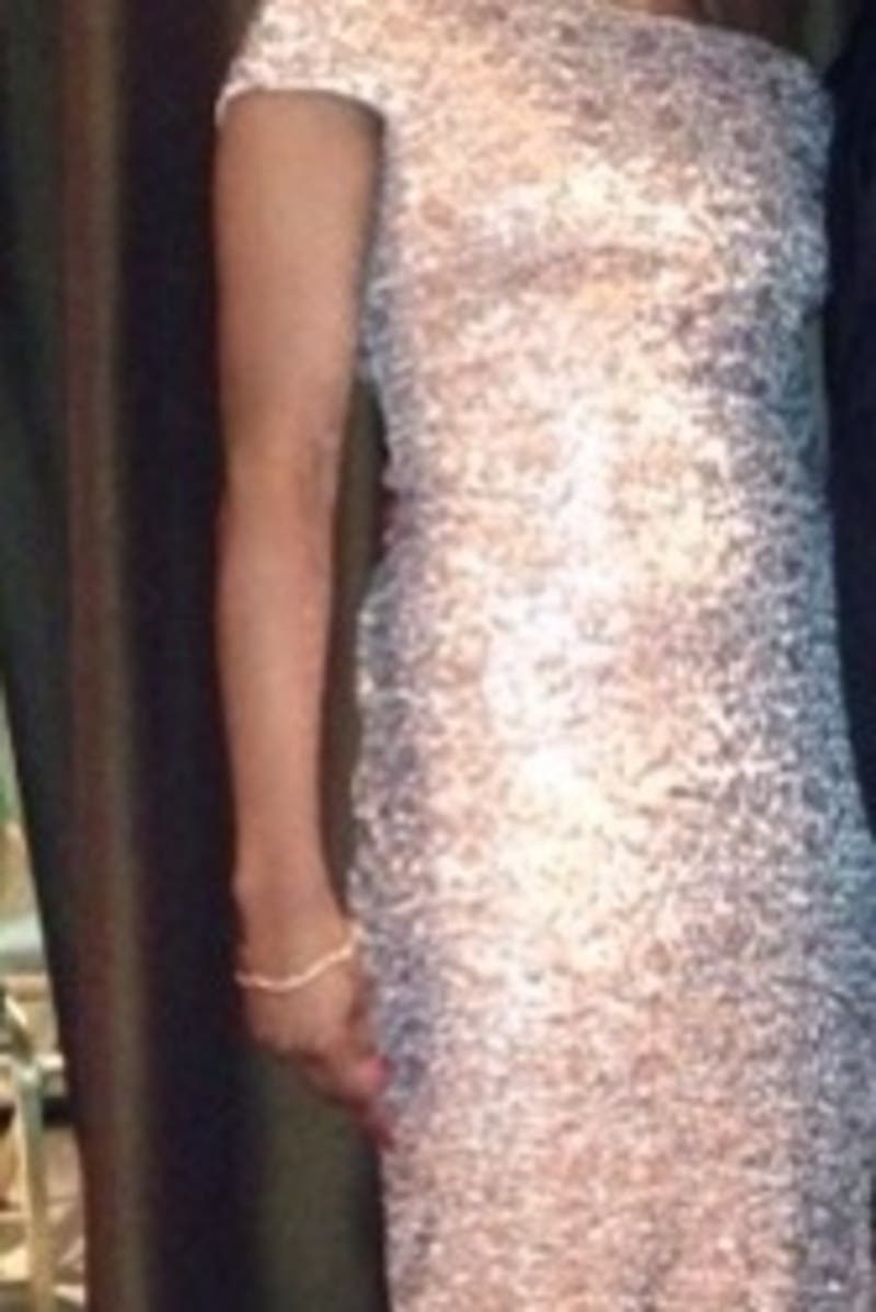 Sneha