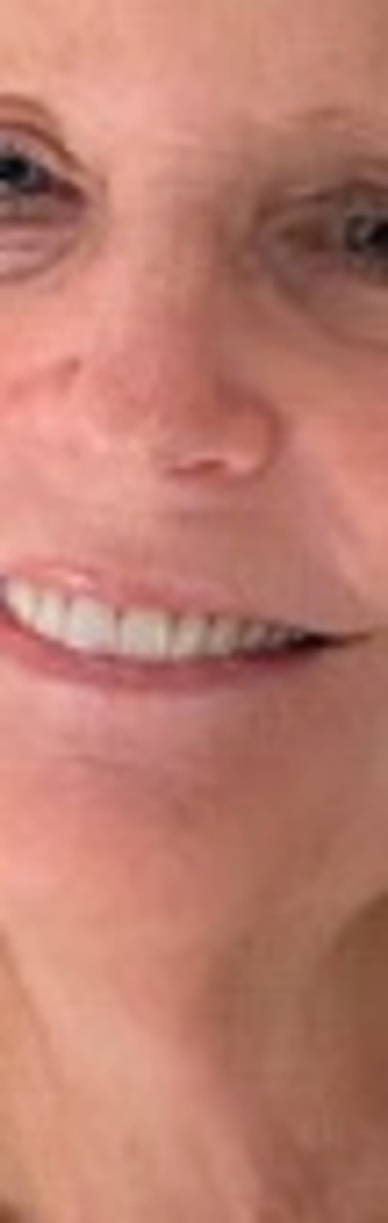 Anne