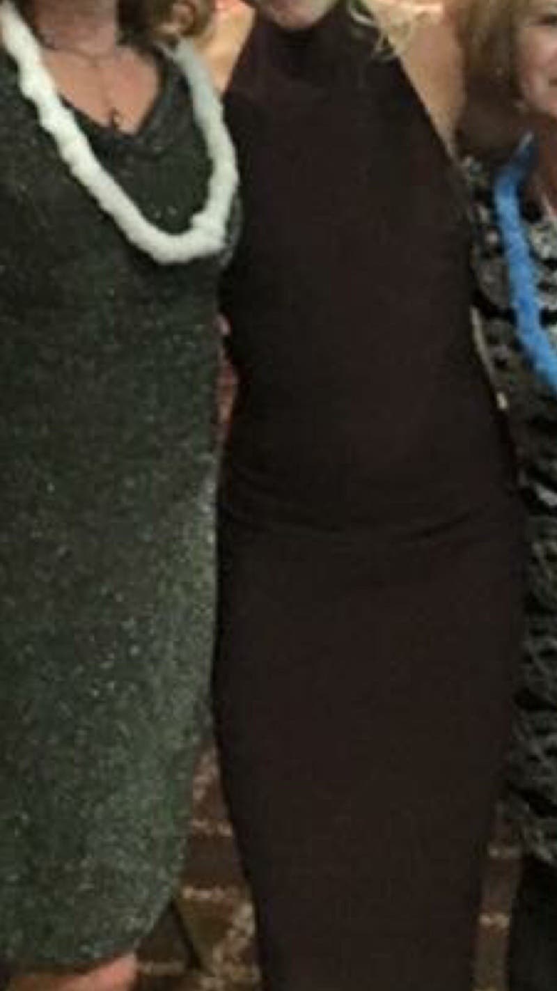 Allison