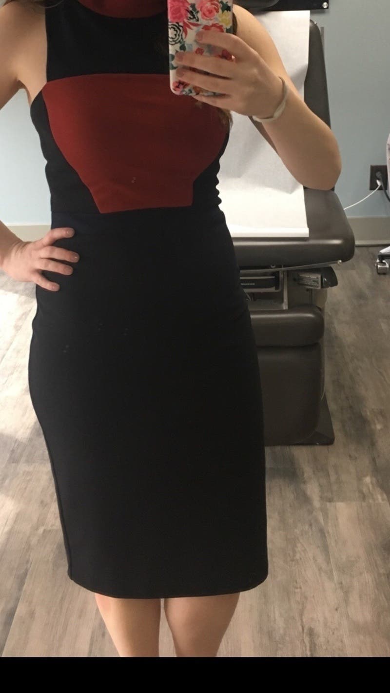 Allie 