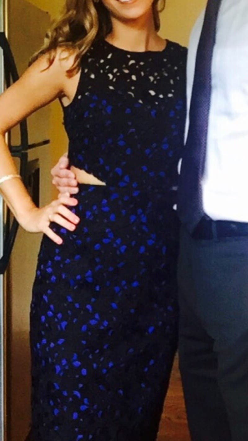 Alli