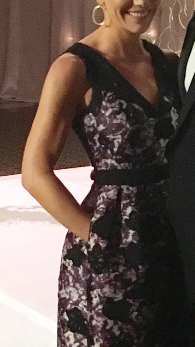 Aly