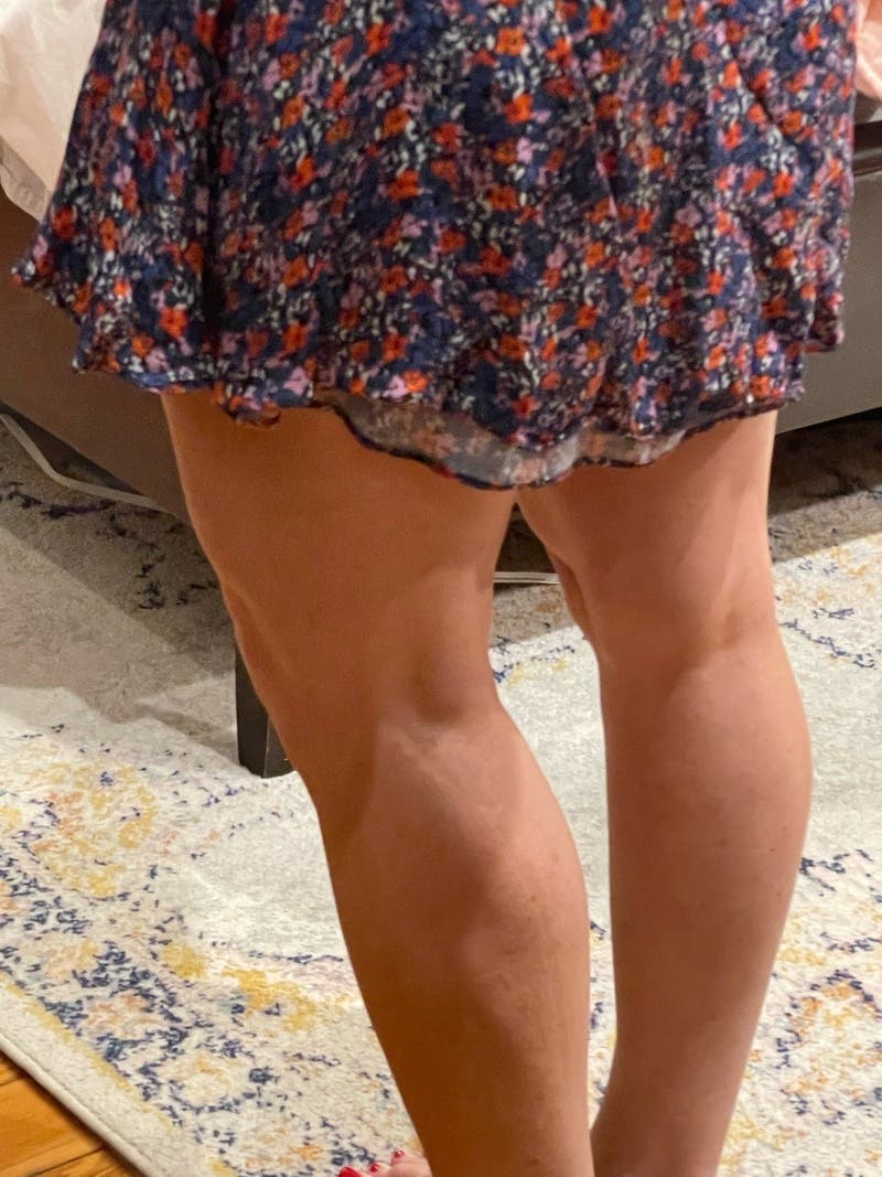 Kymberly