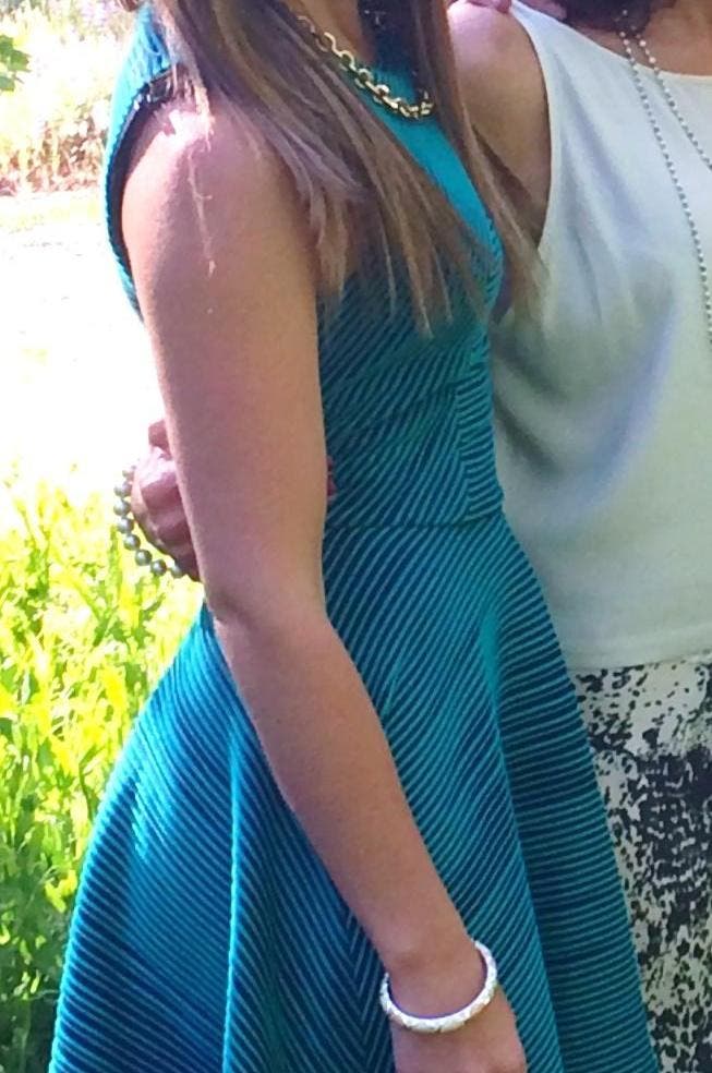 Allison