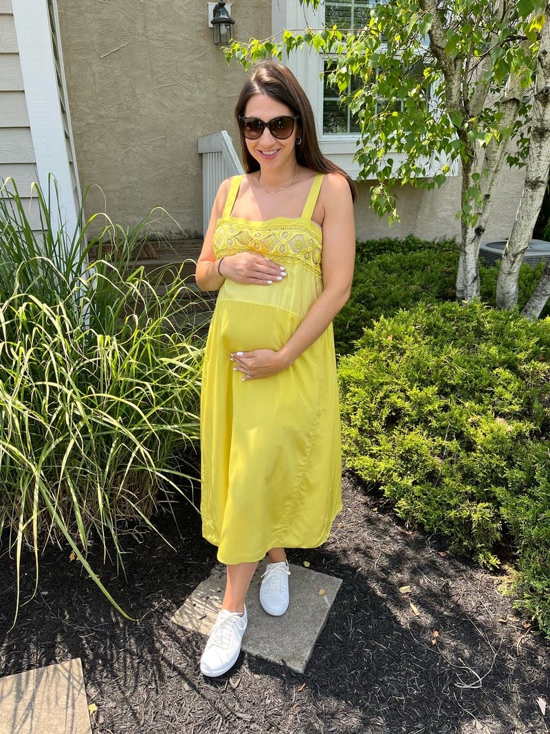 Yellow Midi Dress by Maison Margiela | Rent the Runway