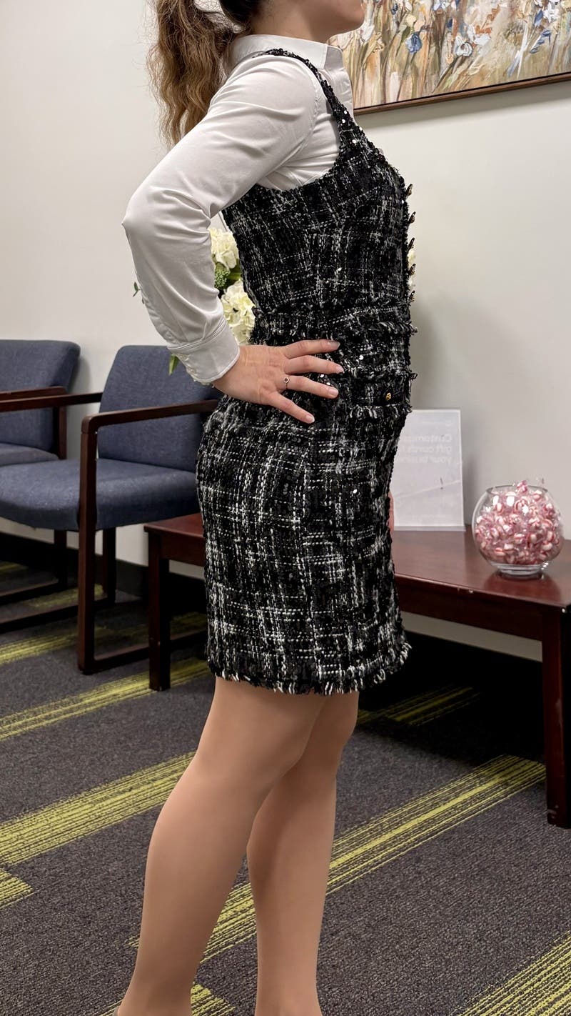 Anca 