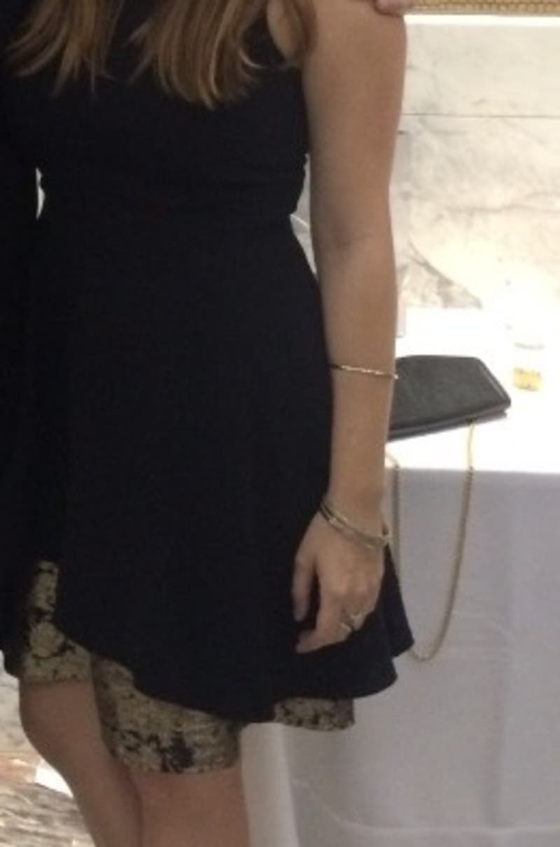 Caroline